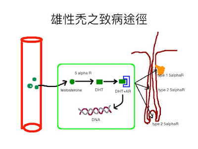 除了finasteride與minoxidil外，還有其他選